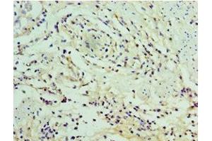 Immunohistochemistry of paraffin-embedded human epityphlon tissue using ABIN7169332 at dilution of 1:100 (SERPINA12 抗体  (AA 20-320))