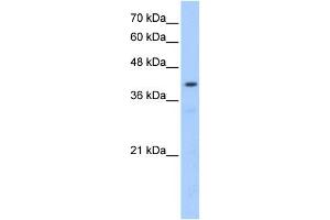 POMT2 antibody used at 0. (POMT2 抗体  (Middle Region))