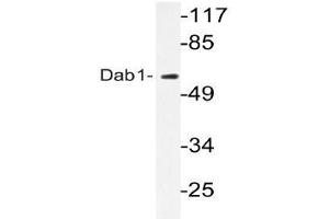 Western blot (WB) analyzes of Dab1 antibody in extracts from HepG2 cells. (DAB1 抗体)