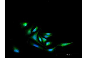 Immunofluorescence of purified MaxPab antibody to NR4A2 on HeLa cell. (NR4A2 抗体  (AA 1-598))