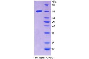 SDS-PAGE analysis of Human NPC2 Protein. (NPC2 蛋白)