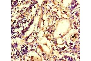Immunohistochemistry of paraffin-embedded human appendix tissue using ABIN7147801 at dilution of 1:100 (IRG1 抗体  (AA 57-257))
