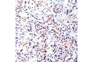 Immunohistochemistry (IHC) image for anti-Folate Hydrolase (Prostate-Specific Membrane Antigen) 1 (FOLH1) (C-Term) antibody (ABIN2470727) (PSMA 抗体  (C-Term))