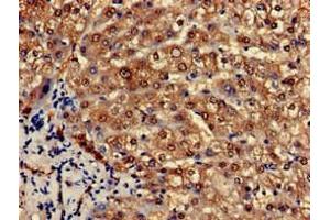 Immunohistochemistry of paraffin-embedded human liver tissue using ABIN7164812 at dilution of 1:100 (PCCA 抗体  (AA 585-720))
