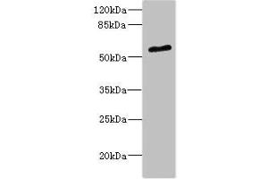 Western blot All lanes: POC1B antibody at 2.
