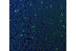 IF analysis of CD68 using anti-CD68 antibody (ABIN7600142).