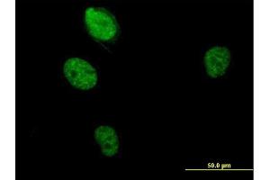 Immunofluorescence of purified MaxPab antibody to RBM5 on HeLa cell.
