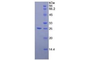 SDS-PAGE (SDS) image for Pepsinogen A ELISA Kit (ABIN6730887)