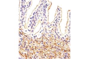 Immunohistochemistry (Paraffin-embedded Sections) (IHC (p)) image for anti-Activating Transcription Factor 6 beta (ATF6B) (AA 560-589), (C-Term) antibody (ABIN651294)