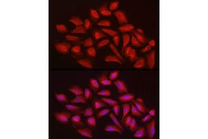 Immunofluorescence analysis of U2OS cells using EXT1 Rabbit pAb (ABIN3022736, ABIN3022737, ABIN3022738 and ABIN6219202) at dilution of 1:100 (40x lens). (EXT1 抗体  (AA 467-746))