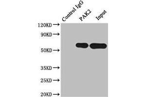 Immunoprecipitating PAK2 in Raji whole cell lysate Lane 1: Rabbit control IgG instead of ABIN7127664 in Raji whole cell lysate. (Recombinant PAK2 抗体)