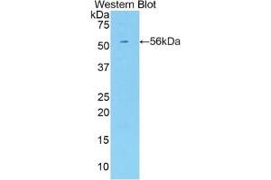 Western blot analysis of the recombinant protein. (KIR3DL2 抗体  (AA 184-435))