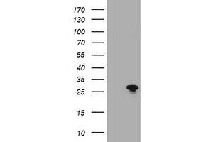 Image no. 1 for anti-B-Cell CLL/lymphoma 10 (BCL10) antibody (ABIN1496850) (BCL10 抗体)