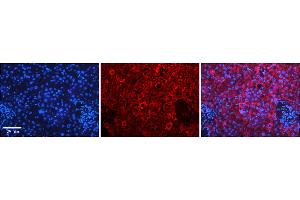 Rabbit Anti-APEH Antibody  Catalog Number: ARP48181_P050 Formalin Fixed Paraffin Embedded Tissue: Human Adult liver  Observed Staining: Cytoplasmic Primary Antibody Concentration: 1:600 Secondary Antibody: Donkey anti-Rabbit-Cy2/3 Secondary Antibody Concentration: 1:200 Magnification: 20X Exposure Time: 0.