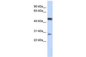 Image no. 1 for anti-Chromosome 13 Open Reading Frame 31 (C13orf31) (AA 179-228) antibody (ABIN6743720) (LACC1 抗体  (AA 179-228))