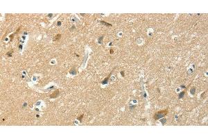 Immunohistochemistry of paraffin-embedded Human brain using ASAH2 Polyclonal Antibody at dilution of 1:50 (ASAH2 抗体)