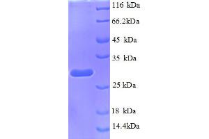SDS-PAGE (SDS) image for Transcription Termination Factor, RNA Polymerase I (TTF1) (AA 11-242), (partial) protein (His tag) (ABIN5712792)