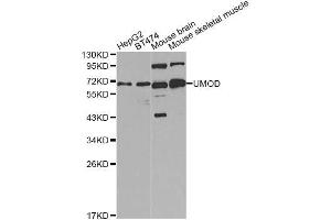 Western blot analysis of extracts of various cell lines, using UMOD Antibody (ABIN5970986) at 1/1000 dilution. (Uromodulin 抗体)