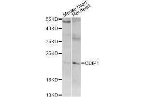Western blot analysis of extracts of various cell lines, using CDIP1 antibody (ABIN6293220) at 1:1000 dilution. (CDIP1 抗体)