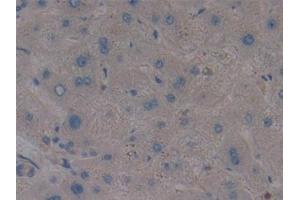 Detection of AMPK Alpha 1 in Human Liver Tissue using Polyclonal Antibody to Protein Kinase, AMP Activated Alpha 1 (AMPK Alpha 1) (PRKAA1 抗体  (AA 28-257))