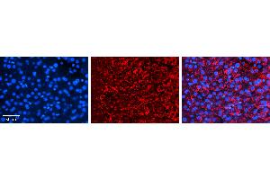 Rabbit Anti-CCPG1 Antibody   Formalin Fixed Paraffin Embedded Tissue: Human Liver Tissue Observed Staining: Cytoplasm and plasma membrane in hepatocytes and endothelial cells in sinusoids Primary Antibody Concentration: N/A Other Working Concentrations: 1:600 Secondary Antibody: Donkey anti-Rabbit-Cy3 Secondary Antibody Concentration: 1:200 Magnification: 20X Exposure Time: 0. (CCPG1 抗体  (Middle Region))