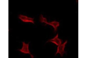 ABIN6274339 staining COLO205 by IF/ICC. (TUSC3 抗体  (Internal Region))