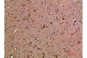 Immunohistochemical analysis of paraffin-embedded human-brain, antibody was diluted at 1:200 (CLCF1 抗体  (AA 171-220))