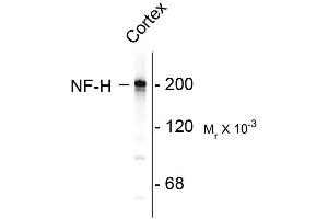 Western blots of rat cortex lysate showing specific immunolableing of the ~ 200k NF-H protein. (NEFH 抗体)