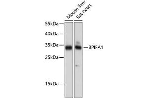 Western blot analysis of extracts of various cell lines, using BPIF antibody (ABIN6132500, ABIN6137634, ABIN6137635 and ABIN6224733) at 1:1000 dilution. (BPIFA1 抗体  (AA 20-256))