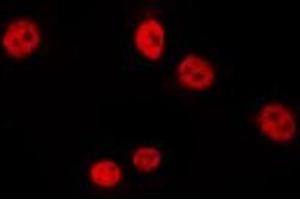 ABIN6275738 staining HepG2 by IF/ICC. (Arx 抗体  (Internal Region))
