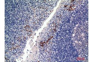 Immunohistochemistry (IHC) analysis of paraffin-embedded Human Tonsils, antibody was diluted at 1:100. (CD19 抗体  (Internal Region))