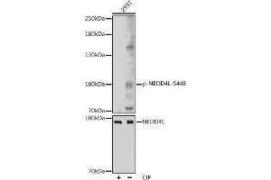 Western blot analysis of extracts of 293T cells, using Phospho-NEDD4L-S448 pAb (ABIN7266883) at 1:1000 dilution or NEDD4L antibody (ABIN6132407, ABIN6144504, ABIN6144505 and ABIN6224109). (NEDD4-2 抗体  (pSer448))