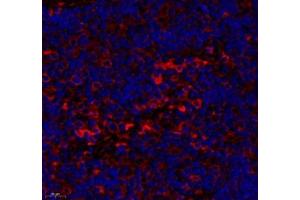 Immunofluorescence of paraffin embedded rat lymph node using CD163b (ABIN7073371) at dilution of 1: 700 (450x lens) (CD163L1 抗体)