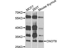 Western blot analysis of extracts of various cells, using CNOT8 antibody. (CNOT8 抗体)