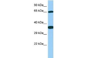 Host: Rabbit Target Name: Galnt13 Sample Type: Rat Stomach lysates Antibody Dilution: 1. (GALNT13 抗体  (C-Term))