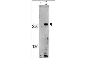 Western blot analysis of PIP5K3 (arrow) using rabbit polyclonal PIP5K3 Antibody (Center) (ABIN391254 and ABIN2841314). (PIKFYVE 抗体  (AA 1531-1561))