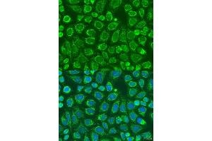 Immunofluorescence analysis of U2OS cells using SNX32 antibody (ABIN6133108, ABIN6148251, ABIN6148252 and ABIN6224028) at dilution of 1:100. (SNX32 抗体  (AA 144-403))