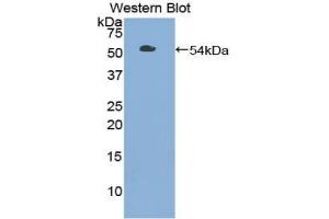 Western blot analysis of the recombinant protein. (TLR3 抗体  (AA 727-905))