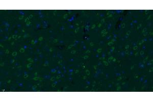 Paraformaldehyde-fixed, paraffin embedded rat brain, Antigen retrieval by boiling in sodium citrate buffer (pH6) for 15min, Block endogenous peroxidase by 3% hydrogen peroxide for 30 minutes, Blocking buffer (normal goat serum) at 37°C for 20min, Antibody incubation with Progestin Receptor Beta/MPRB Antibody  at 1:400 overnight at 4°C, followed by a conjugated secondary Goat Anti-Rabbit IgG antibody -FITC) for 90 minutes, and DAPI for nuclei staining. (Progestin Receptor beta/mprb (AA 251-300) 抗体)
