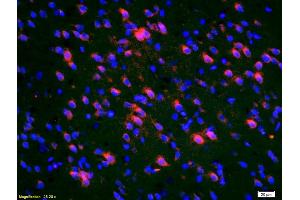 Formalin-fixed and paraffin-embedded rat brain labeled with Anti-Deltex 1 Polyclonal Antibody, Unconjugated (ABIN668125) 1:200, overnight at 4°C, The secondary antibody was Goat Anti-Rabbit IgG, Cy3 conjugated used at 1:200 dilution for 40 minutes at 37°C. (Deltex Homolog 1 抗体  (AA 351-450))