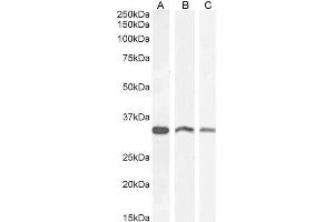 Western Blotting (WB) image for anti-Voltage-Dependent Anion Channel 2 (VDAC2) (C-Term) antibody (ABIN185206)