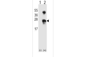 Western blot analysis of GADD45A (arrow) using rabbit polyclonal GADD45A Antibody (N-term) (ABIN389281 and ABIN2839407). (GADD45A 抗体  (N-Term))
