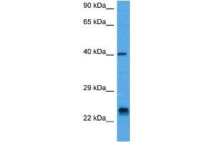 Host:  Mouse  Target Name:  ASCL1  Sample Tissue:  Mouse Pancreas  Antibody Dilution:  1ug/ml (ASCL1 抗体  (N-Term))