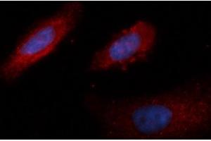 Immunofluorescence (IF) image for anti-Lactate Dehydrogenase B (LDHB) (AA 1-334) antibody (PE) (ABIN5565786) (LDHB 抗体  (AA 1-334) (PE))