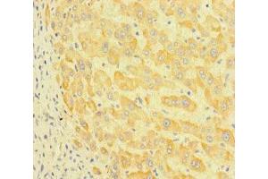 Immunohistochemistry of paraffin-embedded human liver tissue using ABIN7164777 at dilution of 1:100 (LEPREL1 抗体  (AA 301-528))