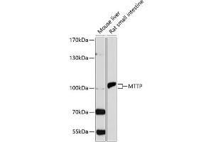 Western blot analysis of extracts of various cell lines, using MTTP antibody (ABIN3022483, ABIN3022484, ABIN3022485 and ABIN6218847) at 1:1000 dilution. (MTTP 抗体  (AA 1-130))