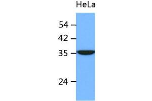 The cell lysates of HeLa (40ug) were resolved by SDS-PAGE, transferred to PVDF membrane and probed with anti-human ING2 antibody (1:1000). (ING2 抗体)