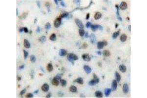 Used in DAB staining on fromalin fixed paraffin-embedded Stomach tissue (NFkB 抗体  (AA 42-367))