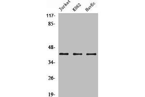 Western Blotting (WB) image for anti-Actin, alpha 2, Smooth Muscle, Aorta (ACTA2) (N-Term) antibody (ABIN7188522)