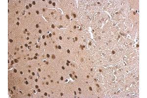 IHC-P Image MEF2C antibody detects MEF2C protein at nucleus on mouse fore brain by immunohistochemical analysis. (MEF2C 抗体)
